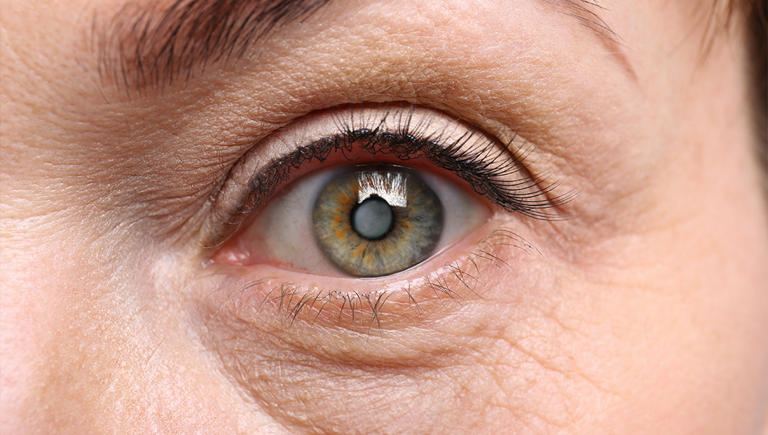 Why Women Have More Eye Disease Than Men - Florida Eye Specialists